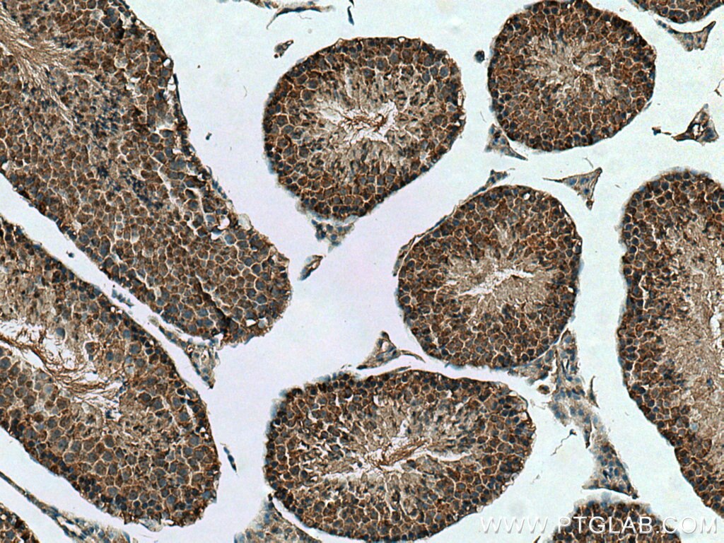 Immunohistochemistry (IHC) staining of mouse testis tissue using UBXN1 Polyclonal antibody (16135-1-AP)