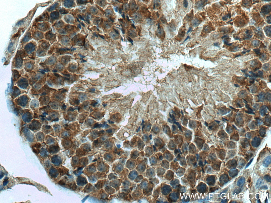 Immunohistochemistry (IHC) staining of mouse testis tissue using UBXN1 Polyclonal antibody (16135-1-AP)