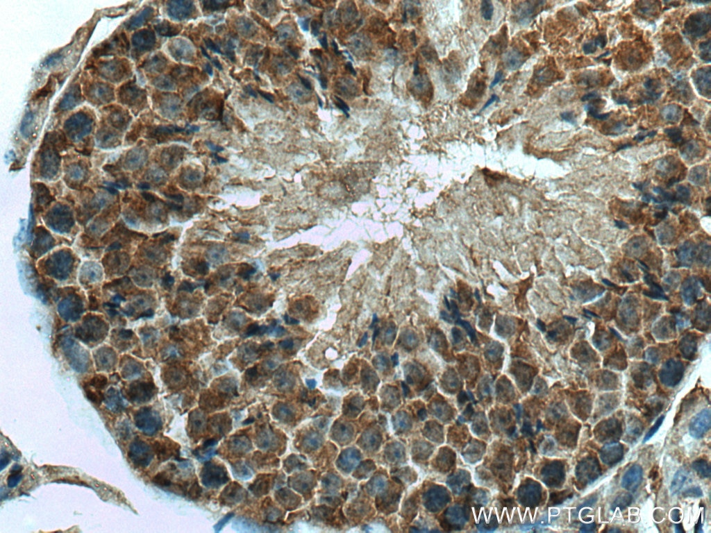 IHC staining of mouse testis using 16135-1-AP