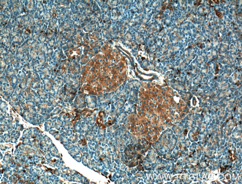 Immunohistochemistry (IHC) staining of human pancreas tissue using UBXN10 Polyclonal antibody (26062-1-AP)