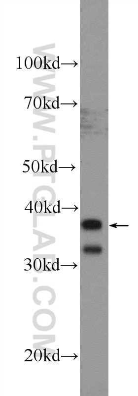 WB analysis of K-562 using 26062-1-AP