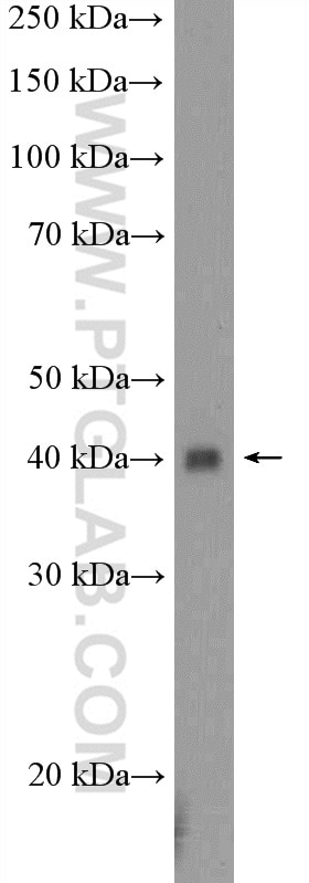 Western Blot (WB) analysis of mouse pancreas tissue using UBXN10 Polyclonal antibody (26062-1-AP)