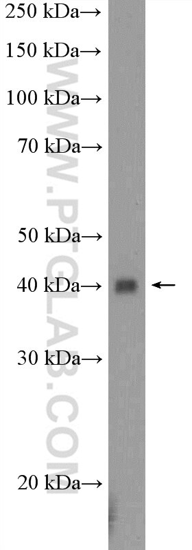 Western Blot (WB) analysis of mouse pancreas tissue using UBXN10 Polyclonal antibody (26062-1-AP)