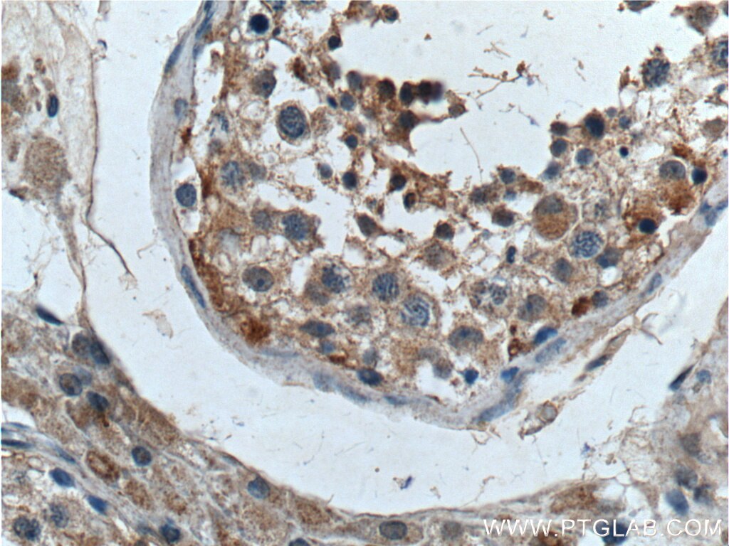 Immunohistochemistry (IHC) staining of human testis tissue using UBXN11 Polyclonal antibody (13109-1-AP)