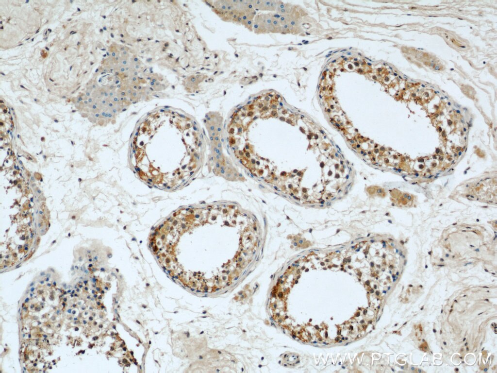 Immunohistochemistry (IHC) staining of human testis tissue using UBXN11 Polyclonal antibody (13109-1-AP)