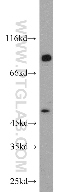 Western Blot (WB) analysis of mouse testis tissue using UBXN11 Polyclonal antibody (13109-1-AP)