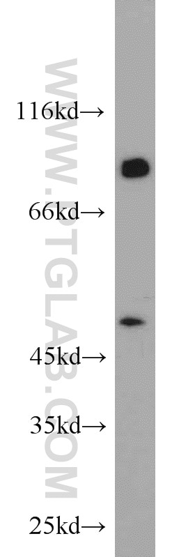 WB analysis of mouse testis using 13109-1-AP