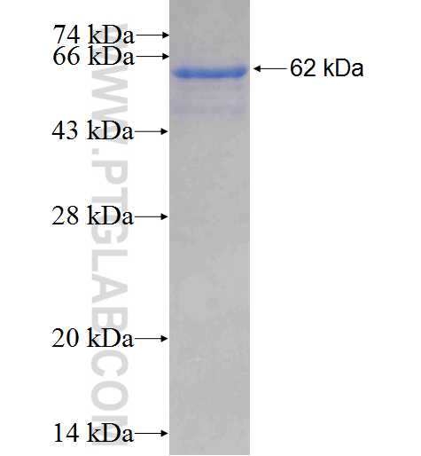 UBXN11 fusion protein Ag3772 SDS-PAGE
