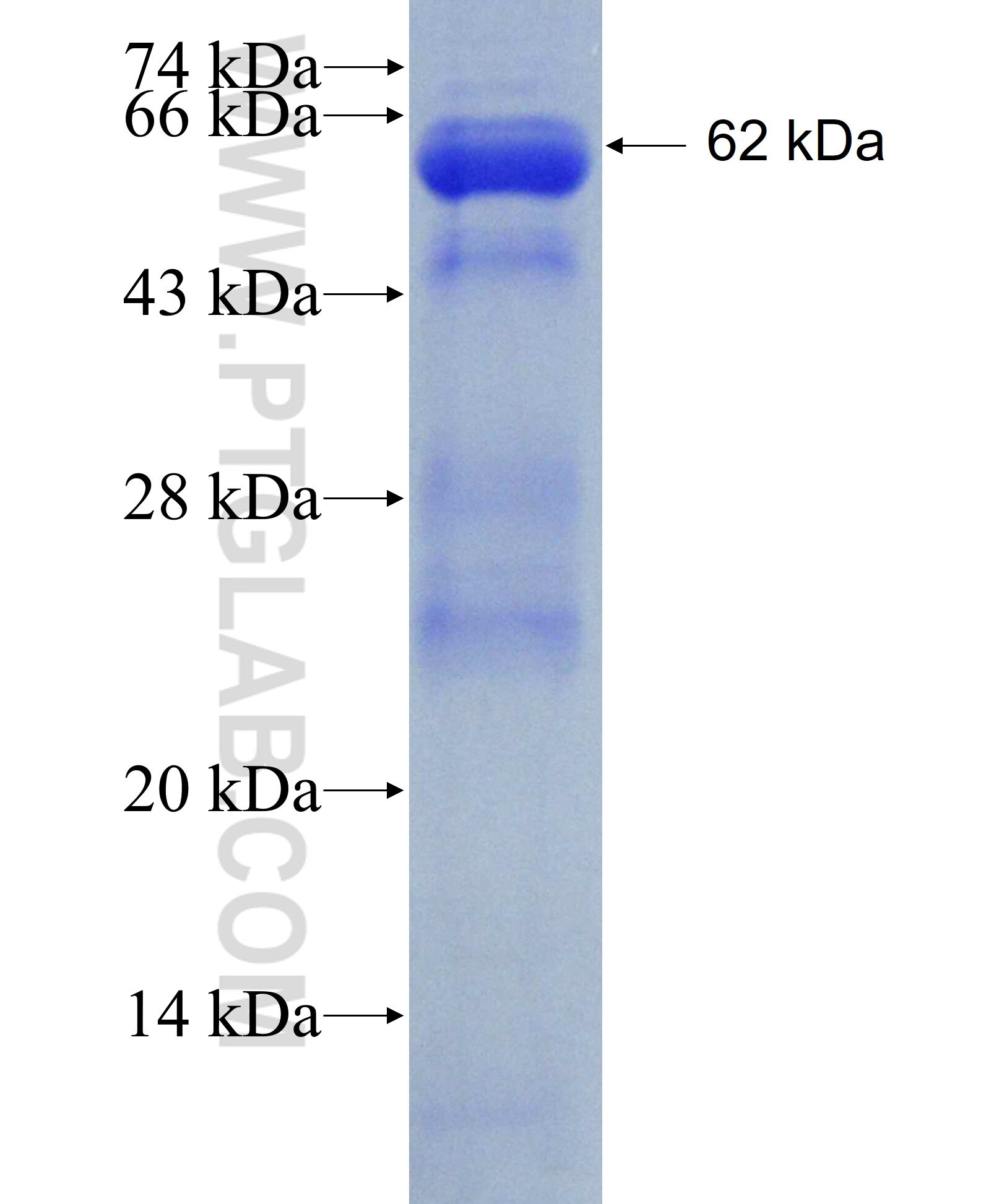 UBXN11 fusion protein Ag3772 SDS-PAGE