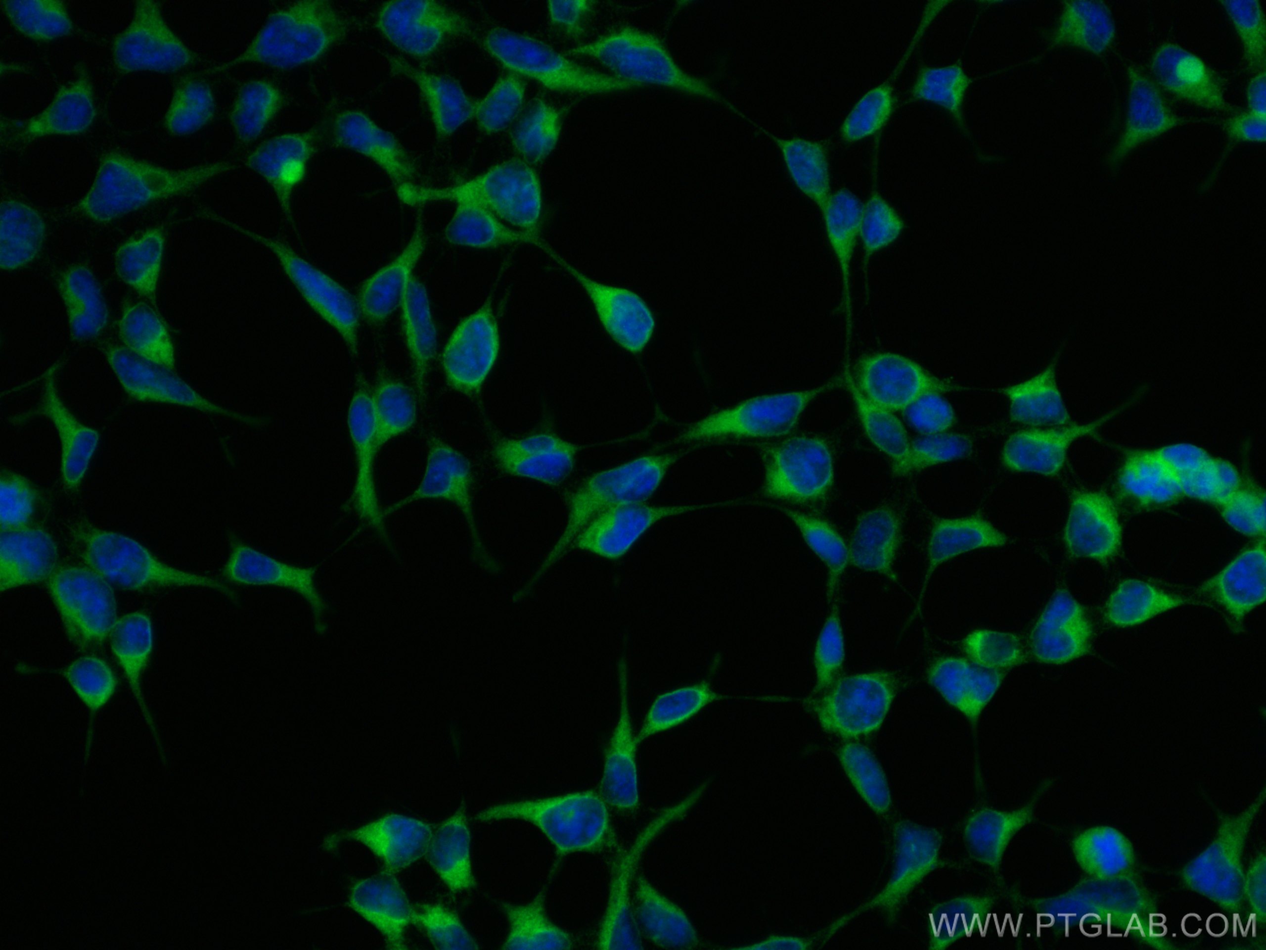 Immunofluorescence (IF) / fluorescent staining of HEK-293 cells using UBXD2 Polyclonal antibody (21052-1-AP)