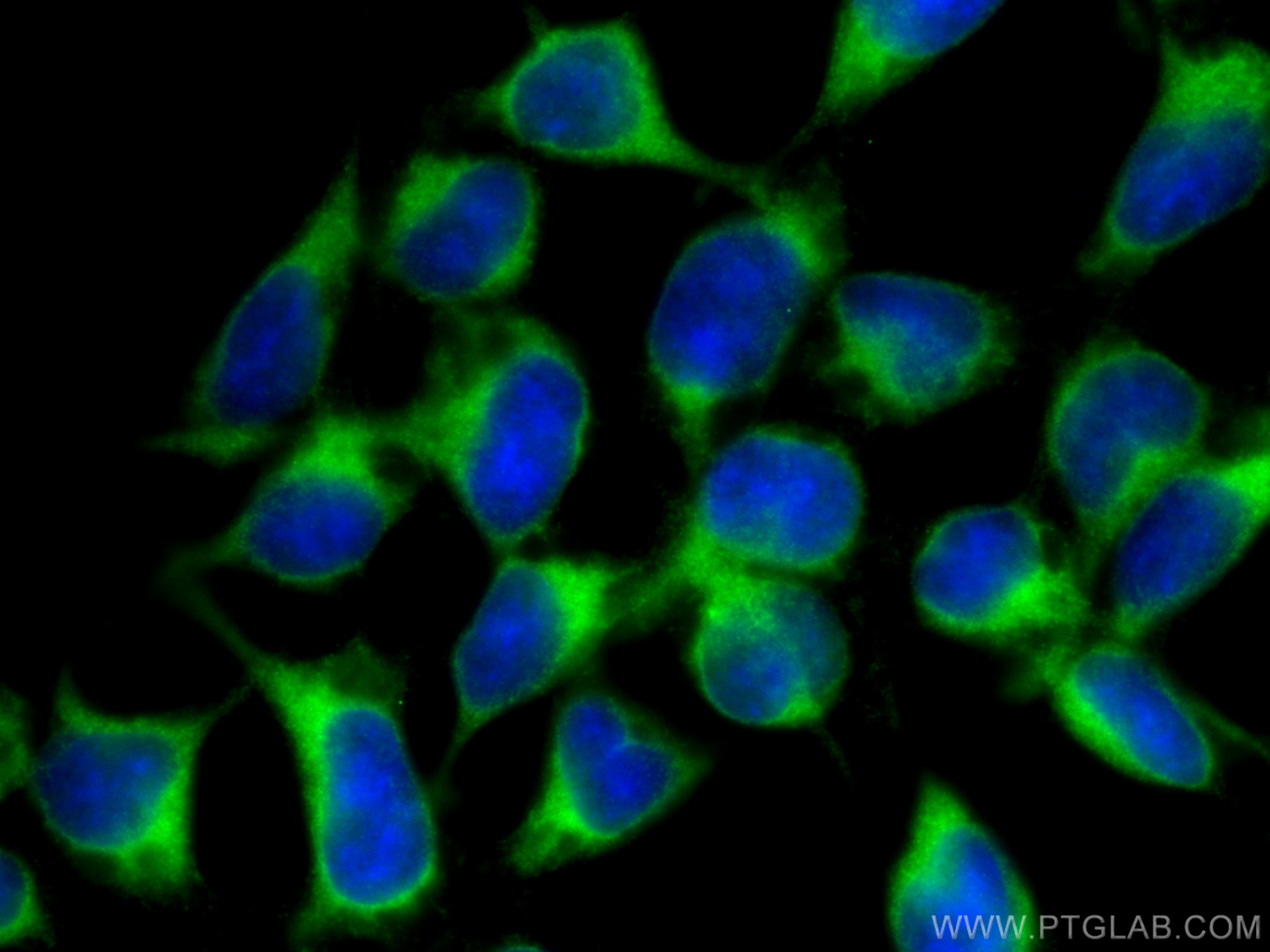 Immunofluorescence (IF) / fluorescent staining of HEK-293 cells using UBXD2 Polyclonal antibody (21052-1-AP)