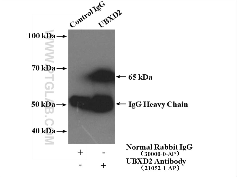 Immunoprecipitation (IP) experiment of mouse brain tissue using UBXD2 Polyclonal antibody (21052-1-AP)