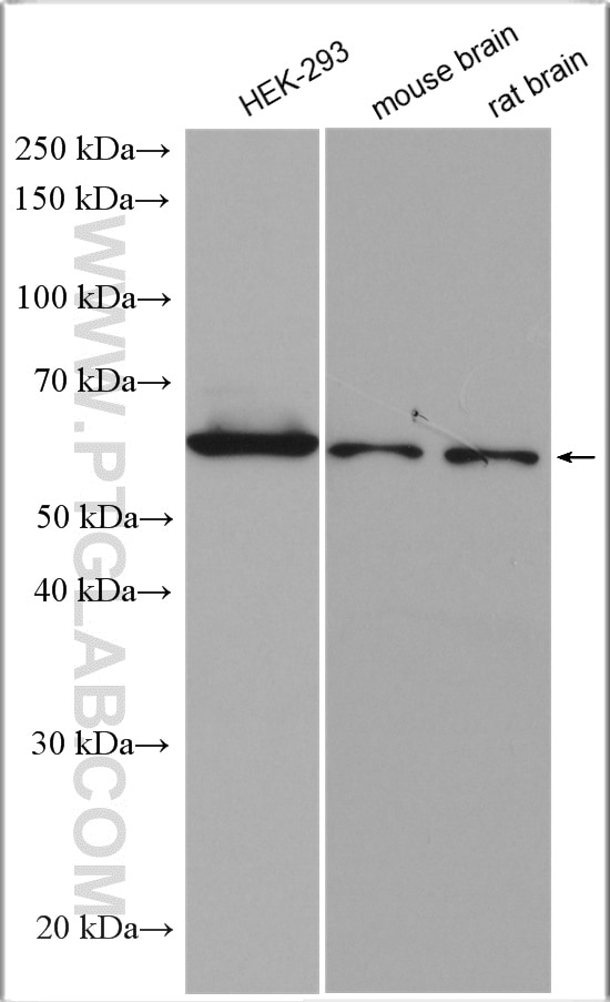 Western Blot (WB) analysis of various lysates using UBXD2 Polyclonal antibody (21052-1-AP)