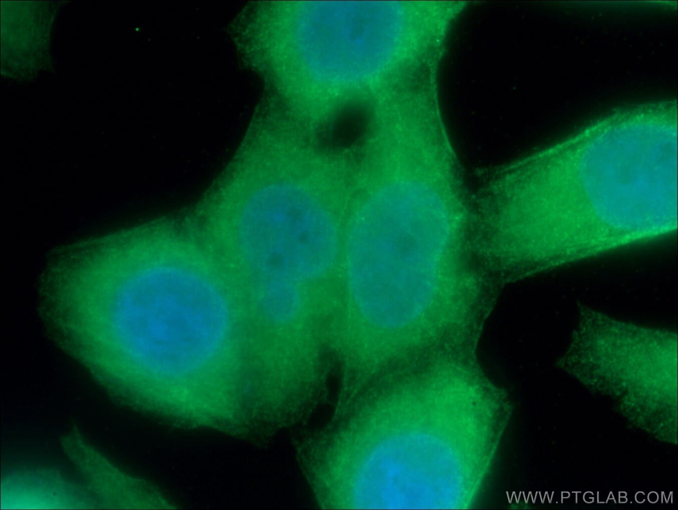 Immunofluorescence (IF) / fluorescent staining of HeLa cells using UBXD1 Polyclonal antibody (14706-1-AP)