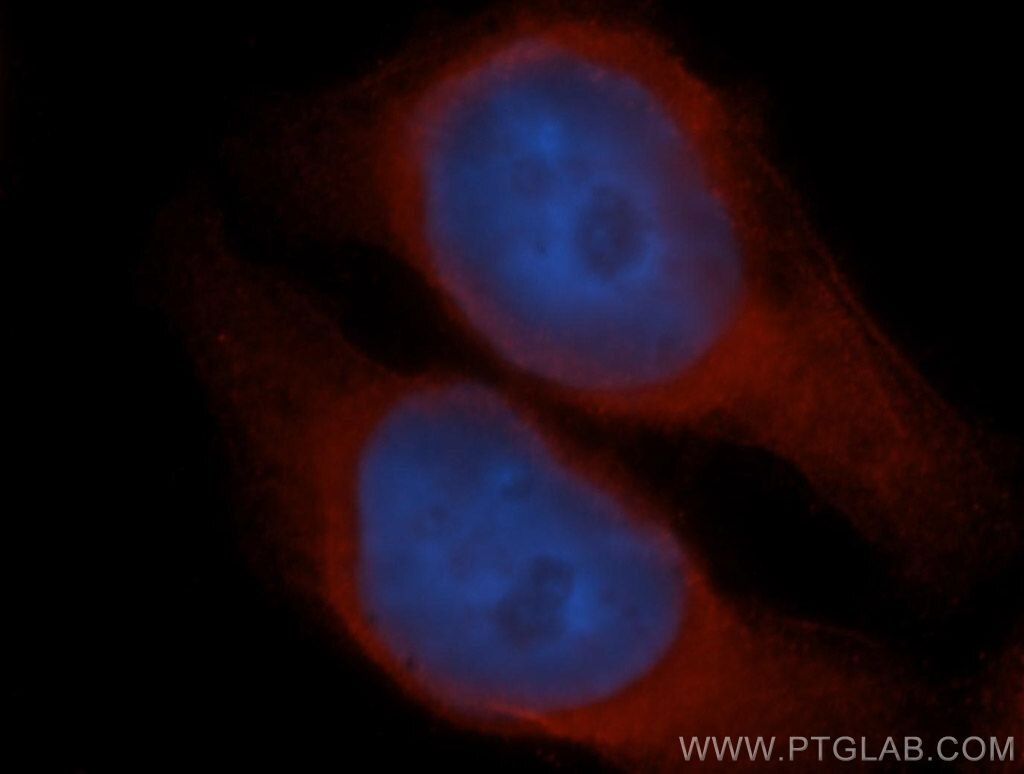 Immunofluorescence (IF) / fluorescent staining of HeLa cells using UBXD1 Polyclonal antibody (14706-1-AP)