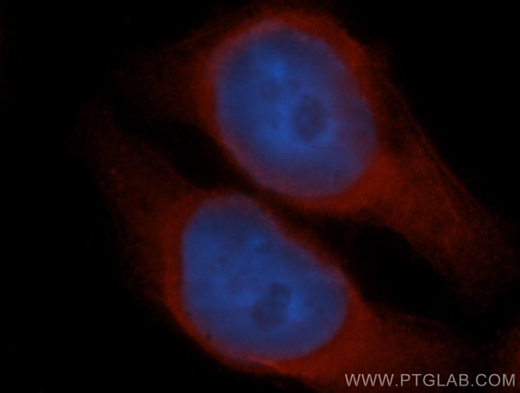 IF Staining of HeLa using 14706-1-AP