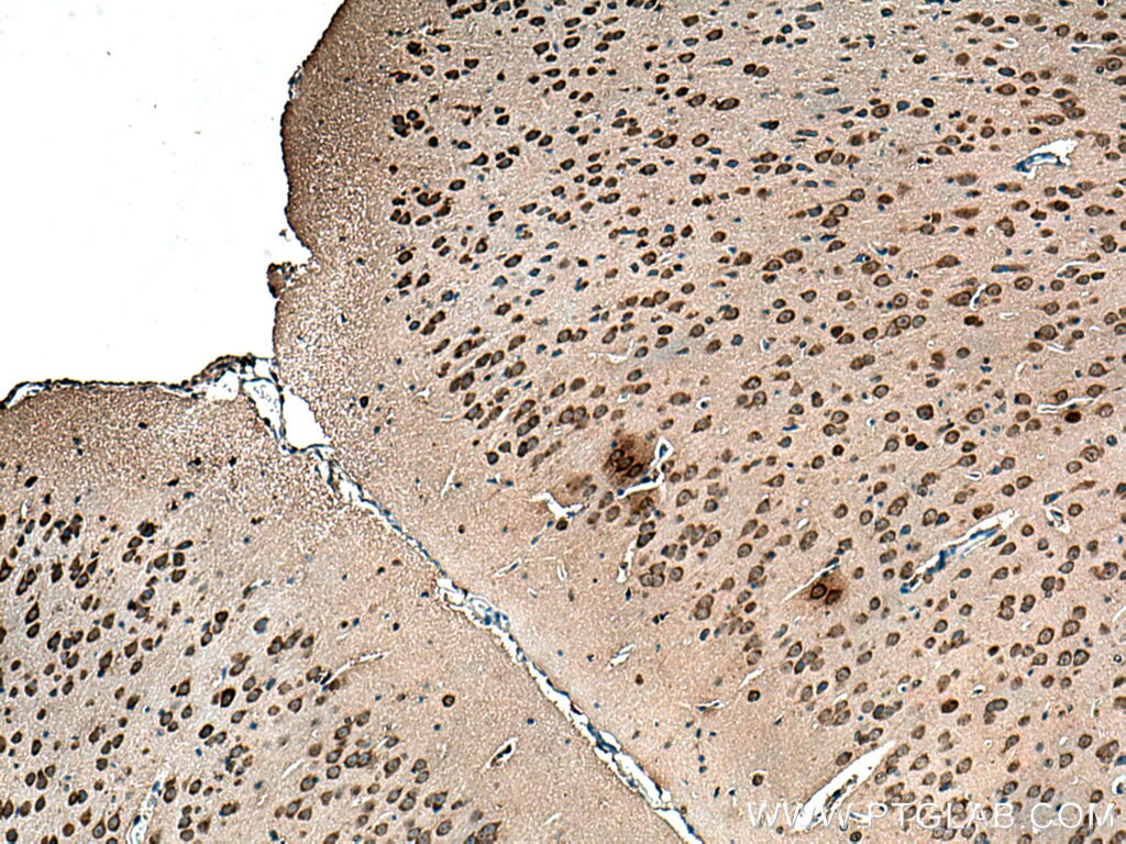 Immunohistochemistry (IHC) staining of mouse brain tissue using UBXD1 Polyclonal antibody (14706-1-AP)