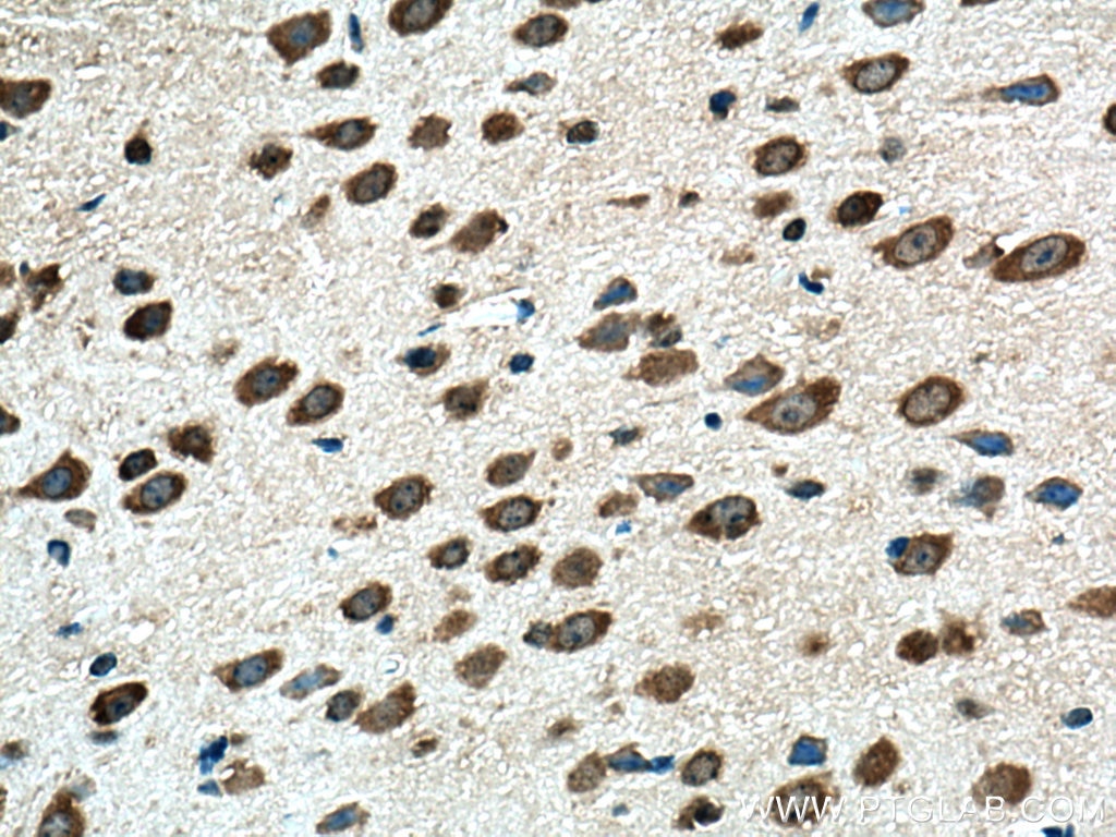 Immunohistochemistry (IHC) staining of mouse brain tissue using UBXD1 Polyclonal antibody (14706-1-AP)