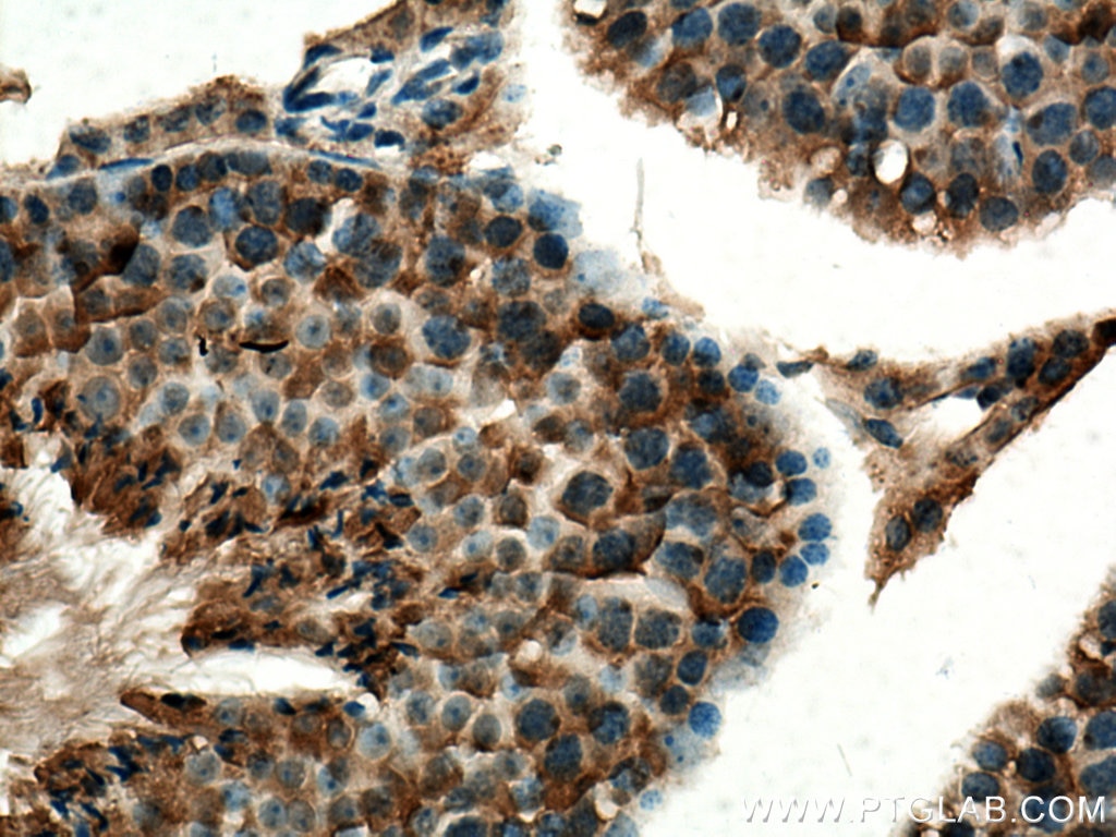 Immunohistochemistry (IHC) staining of mouse testis tissue using UBXD1 Polyclonal antibody (14706-1-AP)