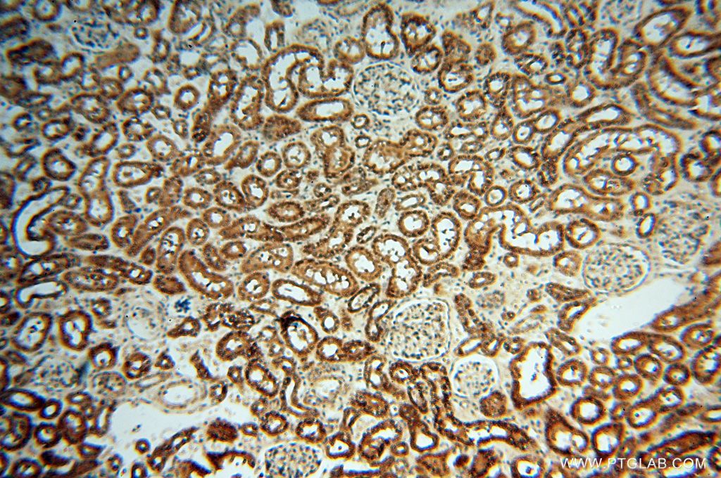 Immunohistochemistry (IHC) staining of human kidney tissue using UBXD1 Polyclonal antibody (14706-1-AP)