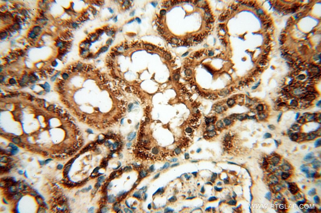 Immunohistochemistry (IHC) staining of human kidney tissue using UBXD1 Polyclonal antibody (14706-1-AP)