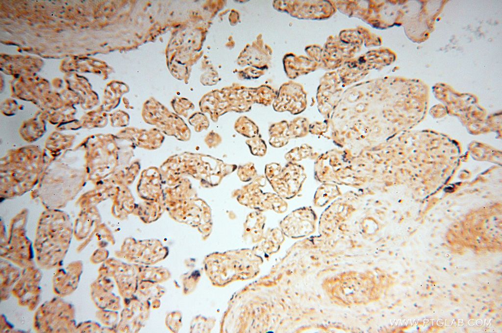 Immunohistochemistry (IHC) staining of human placenta tissue using UBXD1 Polyclonal antibody (14706-1-AP)