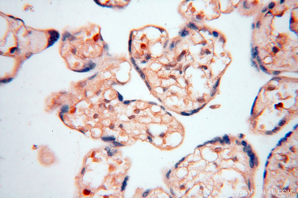 Immunohistochemistry (IHC) staining of human placenta tissue using UBXD1 Polyclonal antibody (14706-1-AP)
