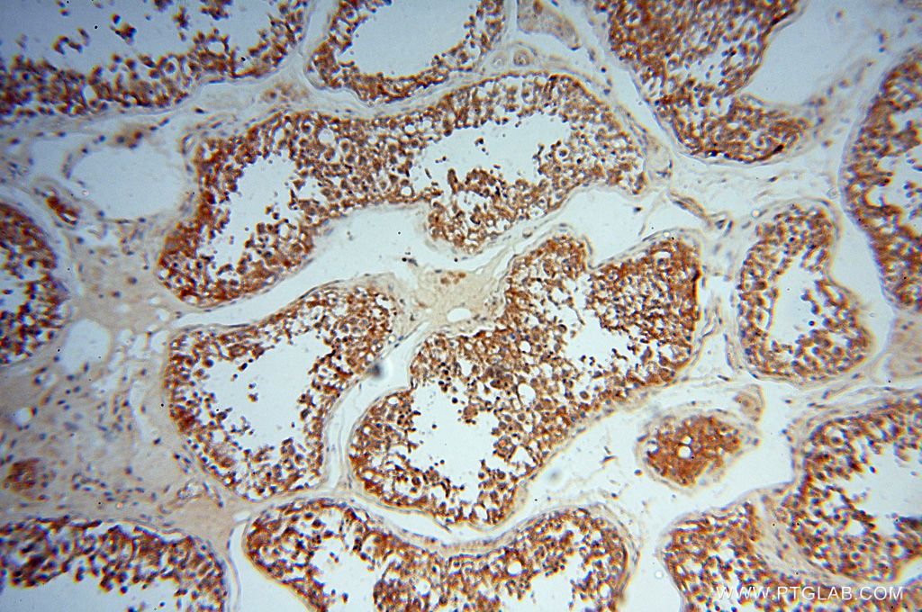Immunohistochemistry (IHC) staining of human testis tissue using UBXD1 Polyclonal antibody (14706-1-AP)