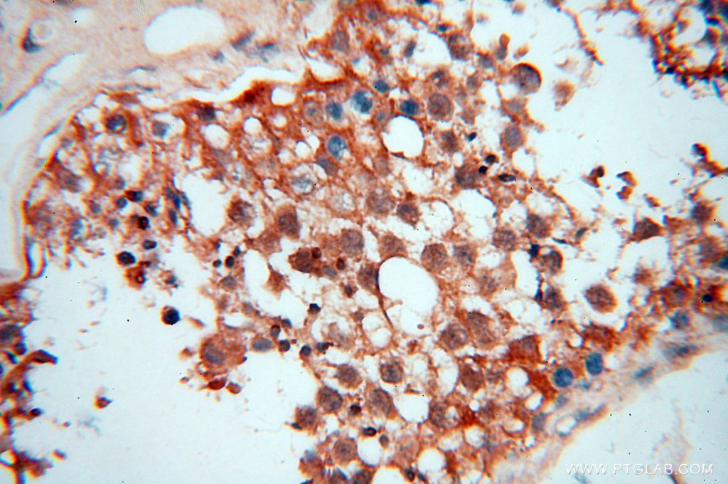 Immunohistochemistry (IHC) staining of human testis tissue using UBXD1 Polyclonal antibody (14706-1-AP)