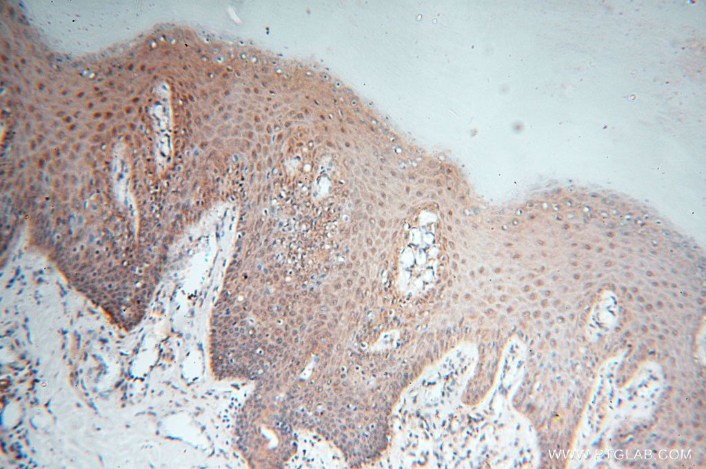 Immunohistochemistry (IHC) staining of human skin tissue using UBXD1 Polyclonal antibody (14706-1-AP)