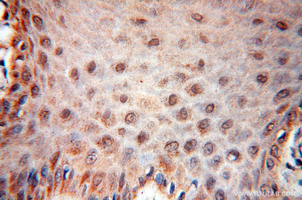 Immunohistochemistry (IHC) staining of human skin tissue using UBXD1 Polyclonal antibody (14706-1-AP)