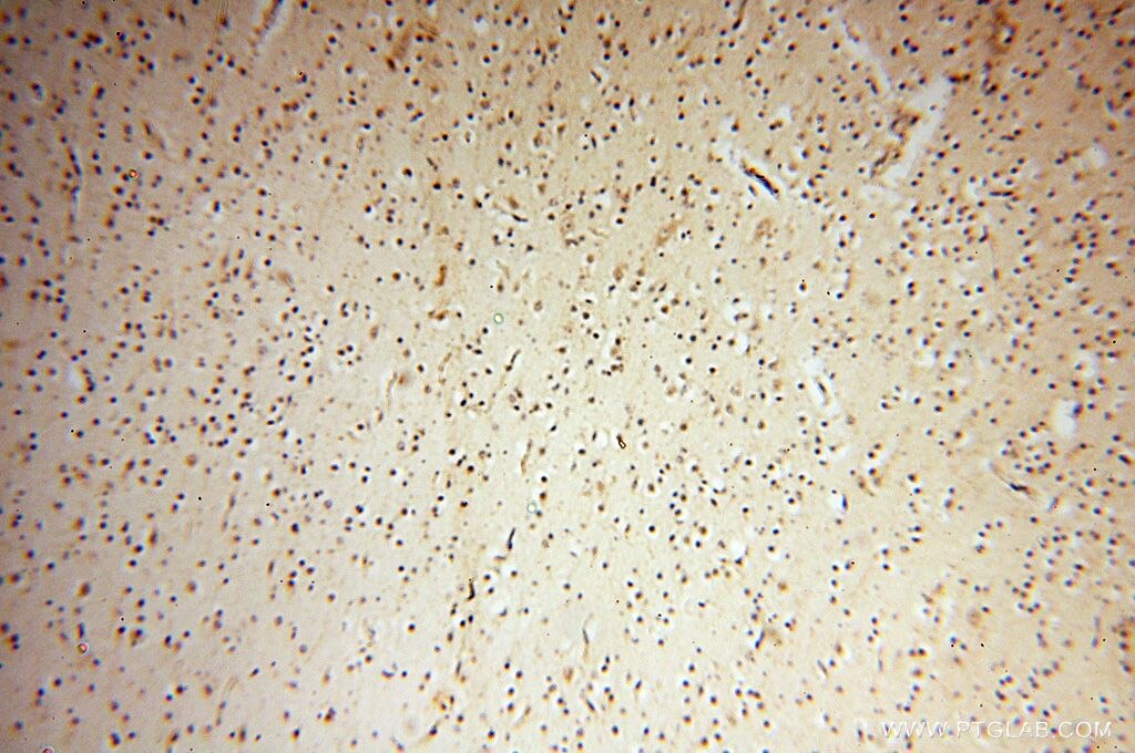 Immunohistochemistry (IHC) staining of human brain tissue using UBXD1 Polyclonal antibody (14706-1-AP)