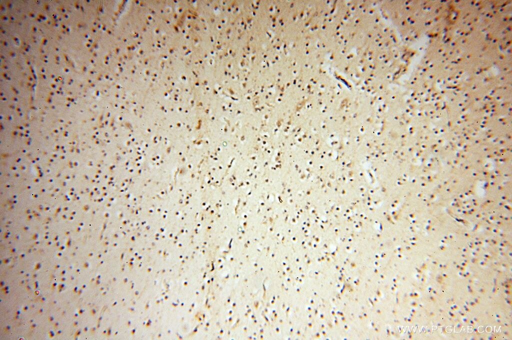 IHC staining of human brain using 14706-1-AP