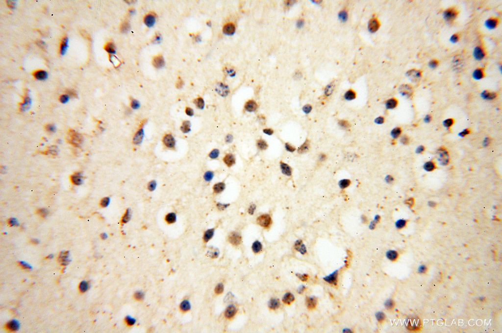 Immunohistochemistry (IHC) staining of human brain tissue using UBXD1 Polyclonal antibody (14706-1-AP)