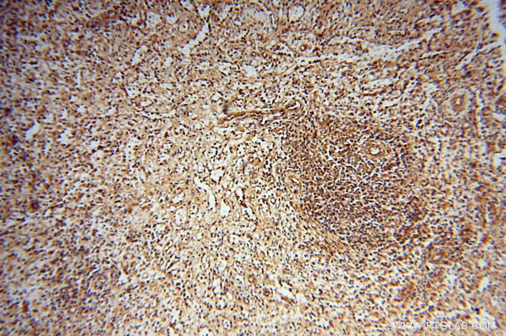 Immunohistochemistry (IHC) staining of human spleen tissue using UBXD1 Polyclonal antibody (14706-1-AP)