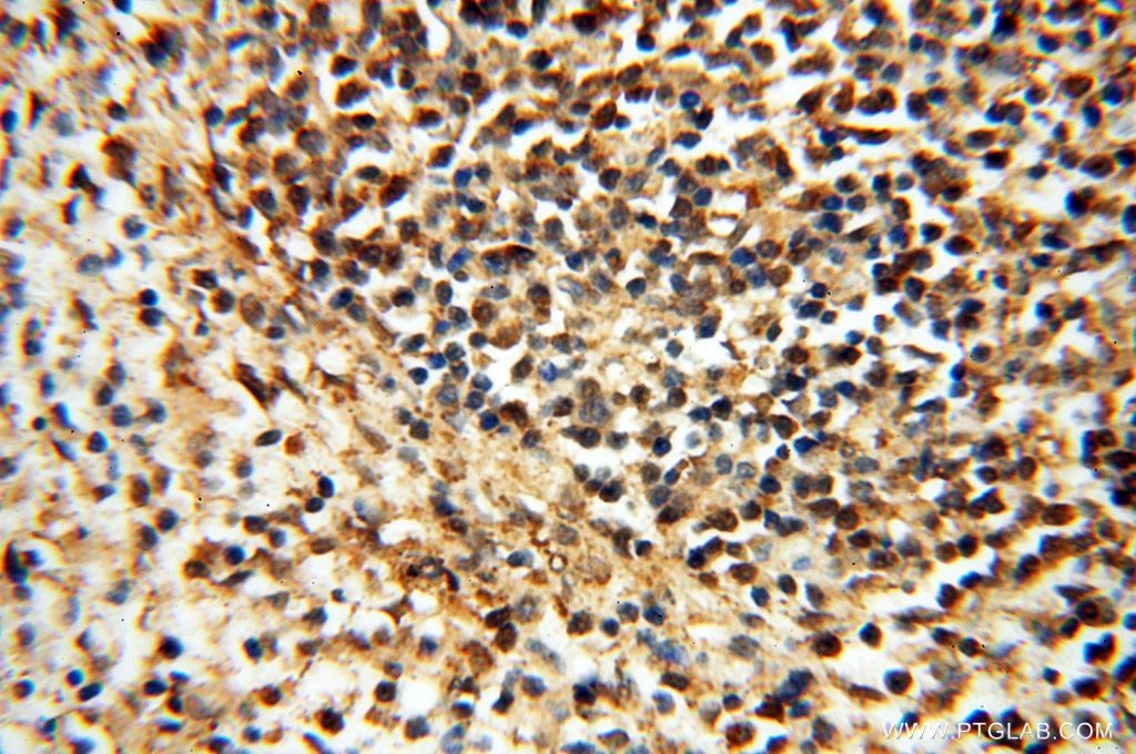 Immunohistochemistry (IHC) staining of human spleen tissue using UBXD1 Polyclonal antibody (14706-1-AP)