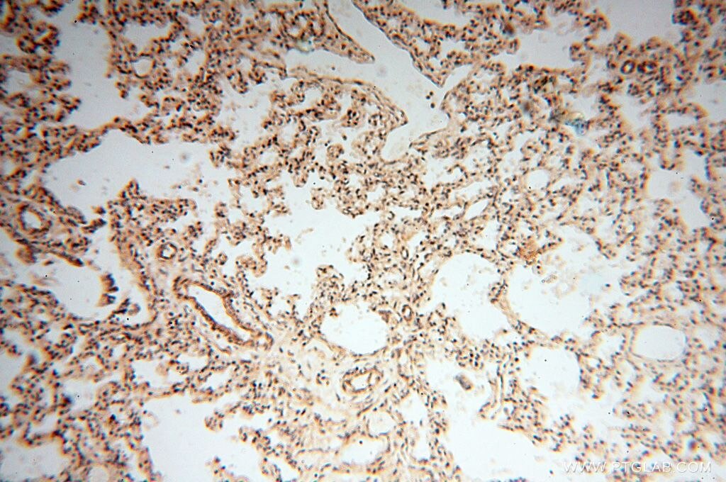 Immunohistochemistry (IHC) staining of human lung tissue using UBXD1 Polyclonal antibody (14706-1-AP)