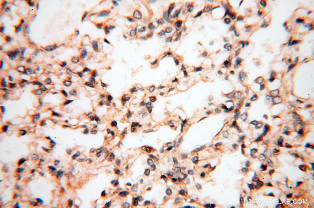 Immunohistochemistry (IHC) staining of human lung tissue using UBXD1 Polyclonal antibody (14706-1-AP)
