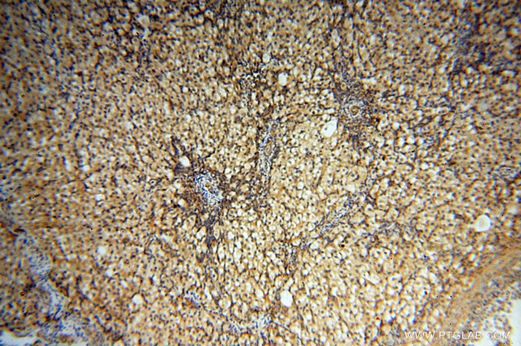 IHC staining of human ovary using 14706-1-AP