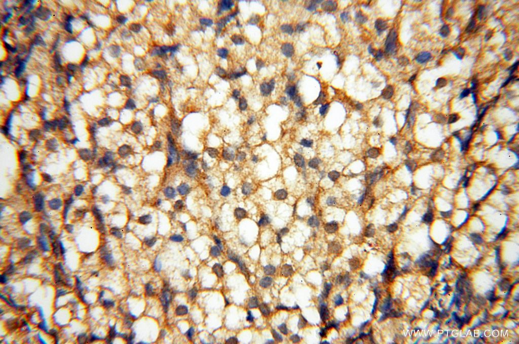 Immunohistochemistry (IHC) staining of human ovary tissue using UBXD1 Polyclonal antibody (14706-1-AP)