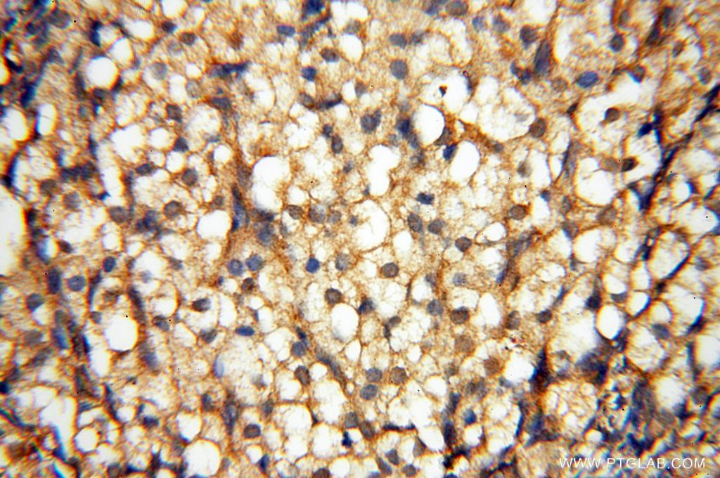 IHC staining of human ovary using 14706-1-AP