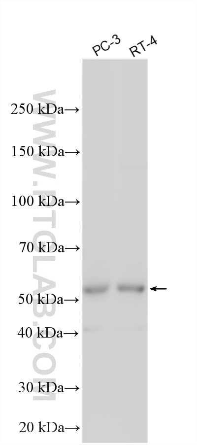 Various lysates were subjected to SDS PAGE followed by western blot with 14706-1-AP (UBXD1 antibody) at dilution of 1:6000 incubated at room temperature for 1.5 hours. Western Blot (WB) analysis of various lysates using UBXD1 Polyclonal antibody (14706-1-AP)