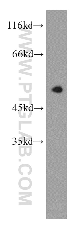 Western Blot (WB) analysis of HeLa cells using UBXD1 Polyclonal antibody (14706-1-AP)