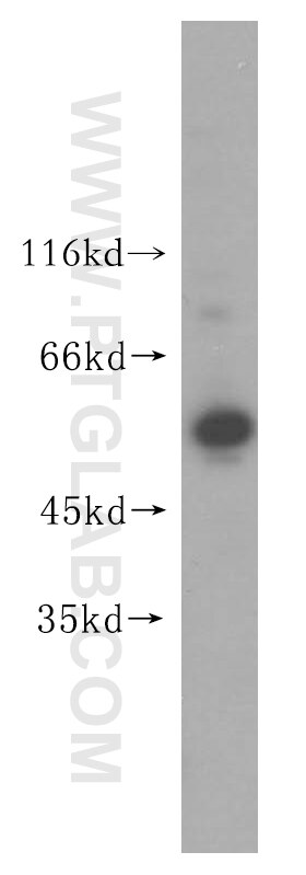 Western Blot (WB) analysis of PC-3 cells using UBXD1 Polyclonal antibody (14706-1-AP)