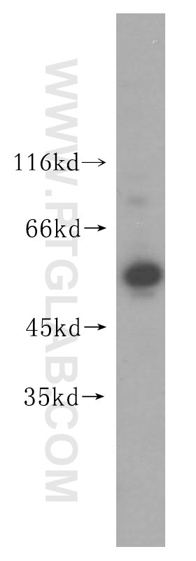 WB analysis of PC-3 using 14706-1-AP