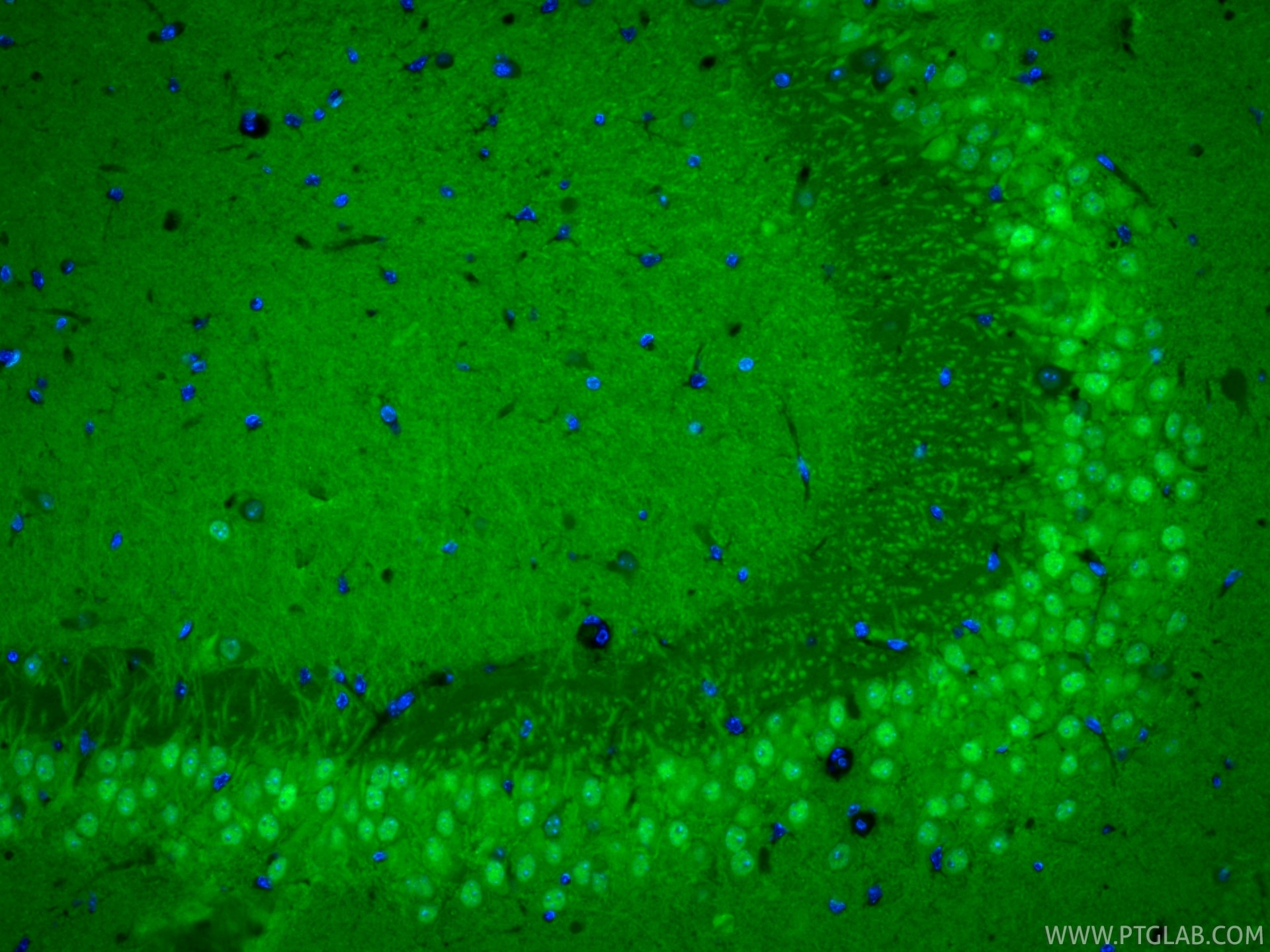 Immunofluorescent analysis of (4% PFA) fixed paraffin-embedded mouse brain tissue using CoraLite® Plus 488 UCH-L1/PGP9.5 antibody (CL488-84154-4, Clone: 241107B2 ) at dilution of 1:200. Heat mediated antigen retrieval with Tris-EDTA buffer (pH 9.0). Immunofluorescence (IF) / fluorescent staining of mouse brain tissue using CoraLite® Plus 488-conjugated UCH-L1/PGP9.5 Recomb (CL488-84154-4)