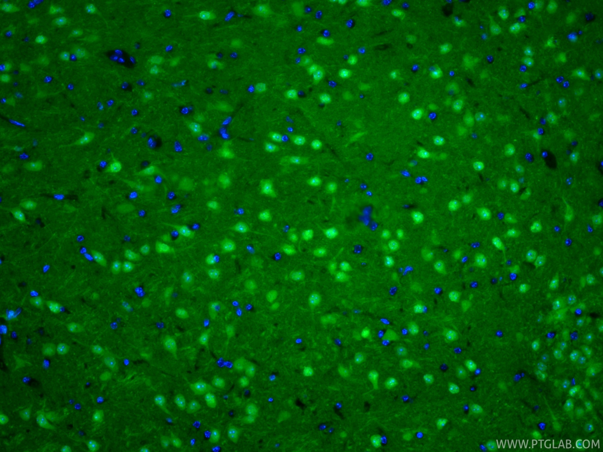 Immunofluorescent analysis of (4% PFA) fixed paraffin-embedded mouse brain tissue using CoraLite® Plus 488 UCH-L1/PGP9.5 antibody (CL488-84154-5, Clone: 241107B3 ) at dilution of 1:200. Heat mediated antigen retrieval with Tris-EDTA buffer (pH 9.0). Immunofluorescence (IF) / fluorescent staining of mouse brain tissue using CoraLite® Plus 488-conjugated UCH-L1/PGP9.5 Recomb (CL488-84154-5)