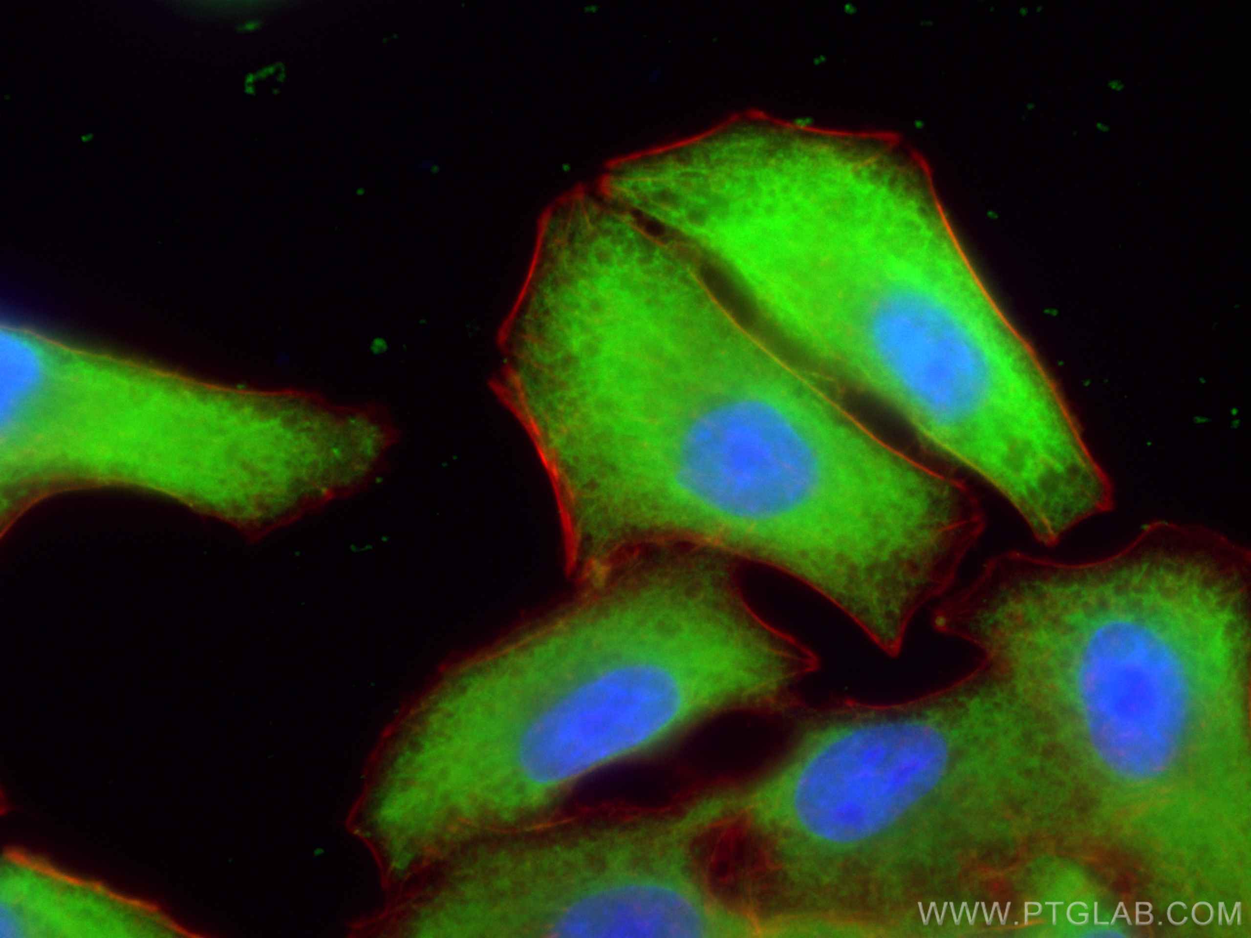 Immunofluorescence (IF) / fluorescent staining of A549 cells using UCHL1/PGP9.5 Polyclonal antibody (14730-1-AP)