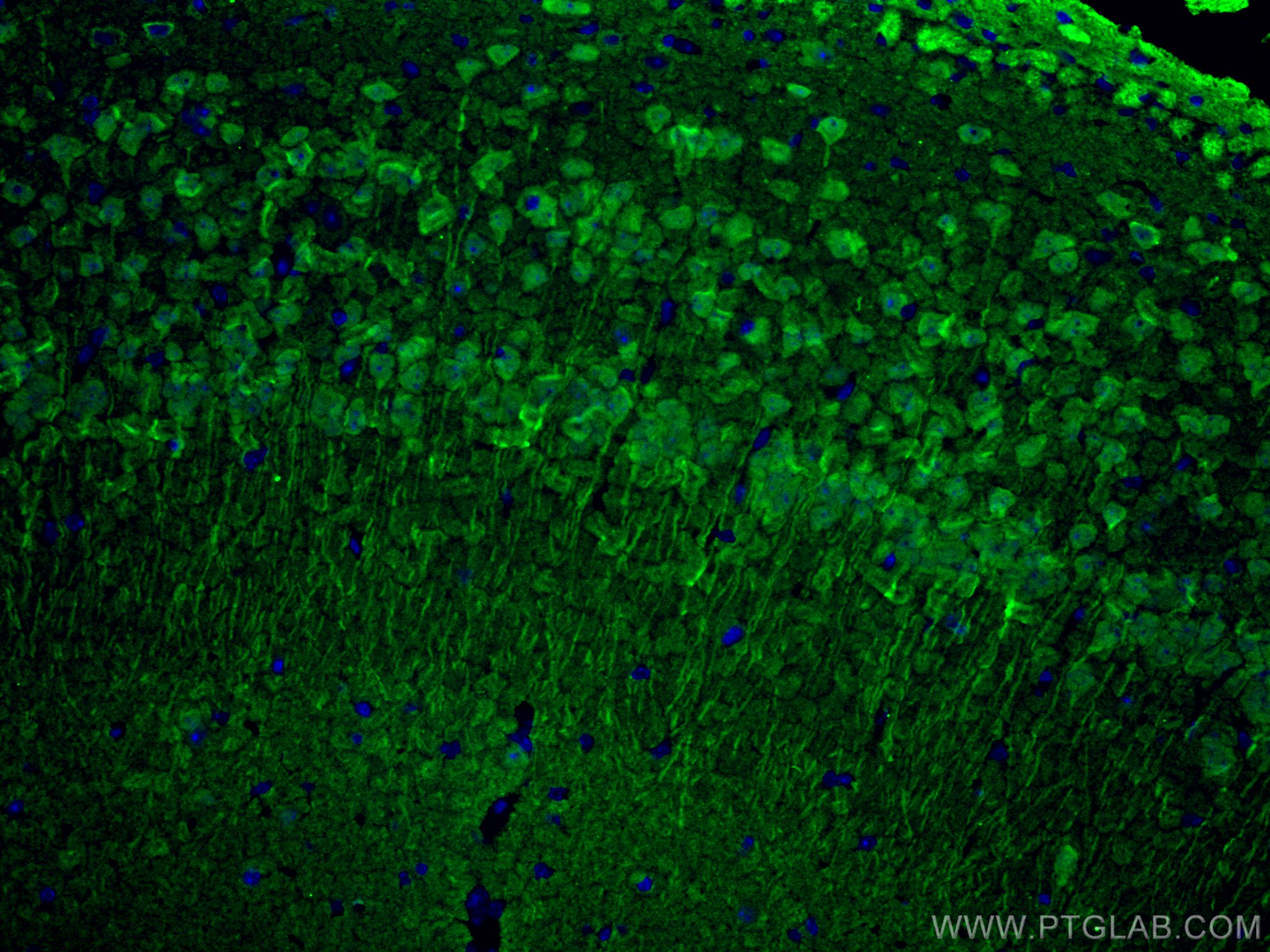 IF Staining of mouse brain using 14730-1-AP