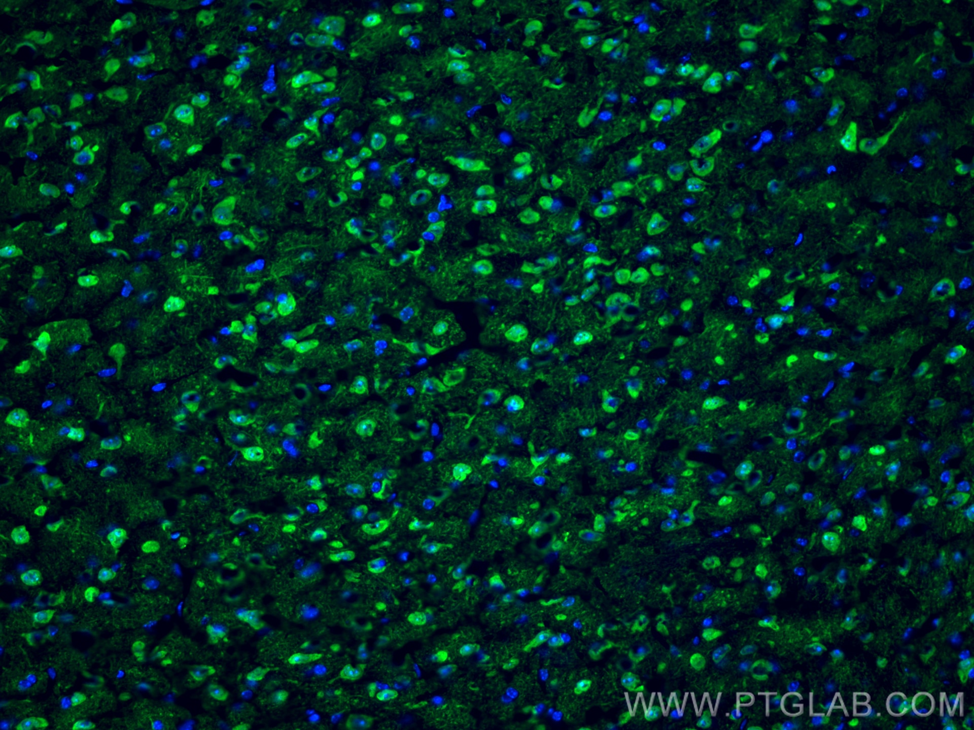 Immunofluorescence (IF) / fluorescent staining of mouse brain tissue using UCH-L1/PGP9.5 Polyclonal antibody (14730-1-AP)